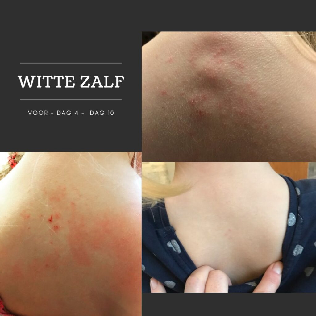 wzpic2
